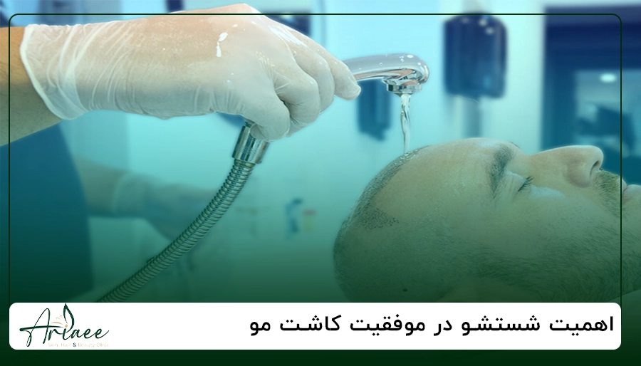اهمیت شستشو در موفقیت کاشت مو