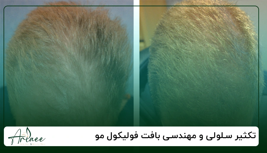 تکثیر سلولی و مهندسی بافت فولیکول مو
