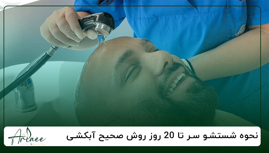 نحوه شستشو سر تا 20 روز روش صحیح آبکشی