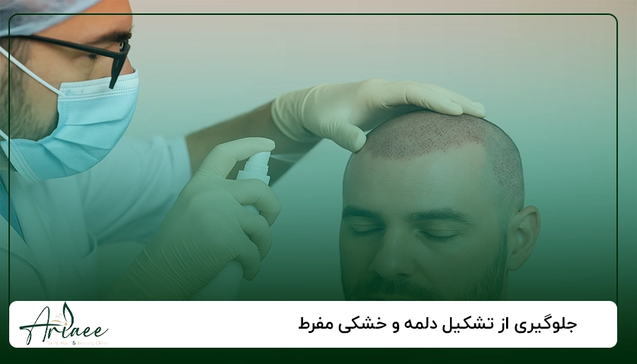 جلوگیری از تشکیل دلمه و خشکی مفرط