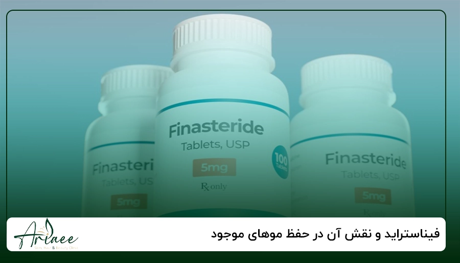 فیناستراید و نقش آن در حفظ موهای موجود