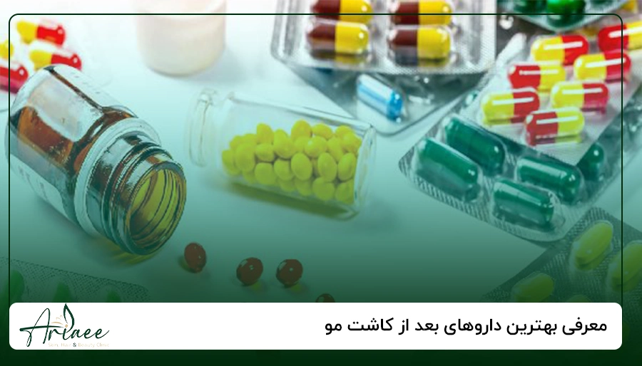 معرفی بهترین داروهای بعد از کاشت مو