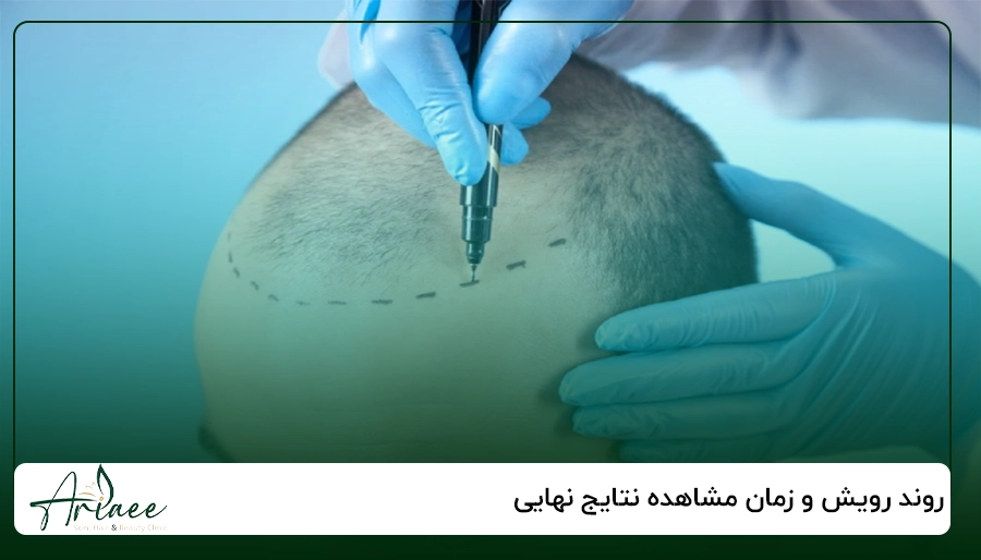 روند رویش و زمان مشاهده نتایج نهایی